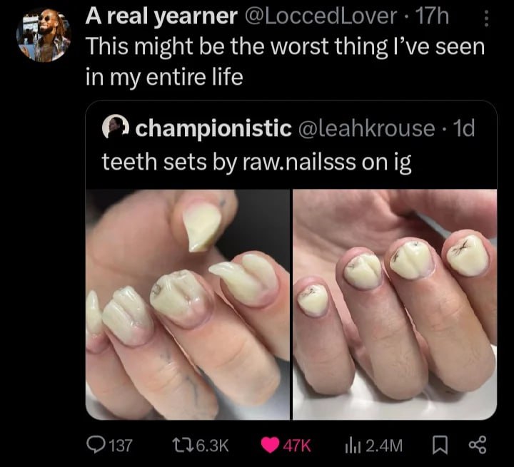 Атеа!уеагпег This might be the worst thing I’ve seen in my entire life championistic @leahkrouse 19 teeth sets raw.nailsss on (2137