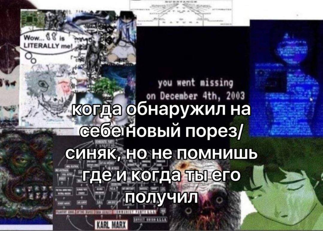 обнаружил себы Новый порез/ синяк, не ПОМНИШЬ гдеи когда получил”