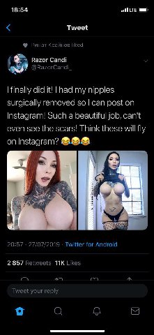 18:54 Tweet Ринат Крайнов liked Razor Сапа! @RazorCandi_ finally did it! had my nipples surgically removed so can post on Instagram! Such a beautiful job, can't even see the scars! Think these fly on 