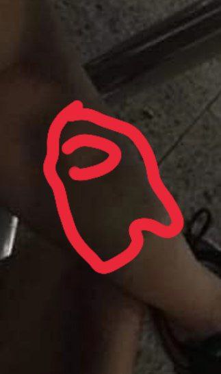SUS