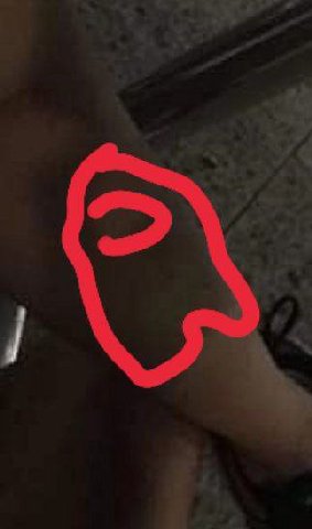 SUS