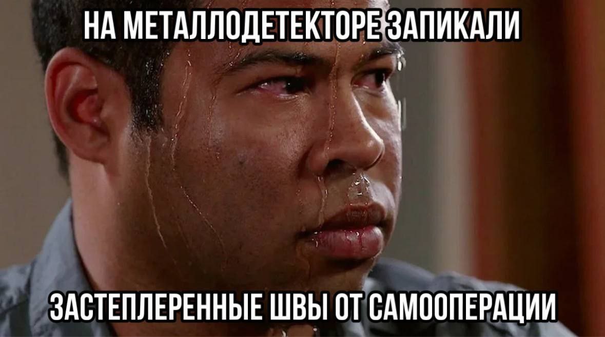 НА МЕТАЛЛОДЕТЕКТОРЕЗАПИКАЛИ ЗАСТЕПЛЕРЕННЫЕ ШВЫ ОТ САМООПЕРАЦИИ