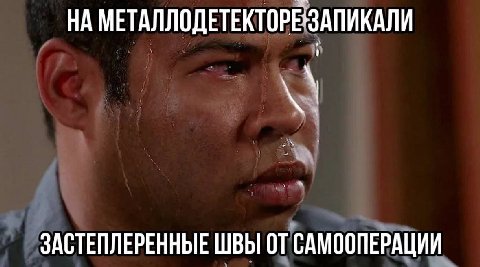 НА МЕТАЛЛОДЕТЕКТОРЕЗАПИКАЛИ ЗАСТЕПЛЕРЕННЫЕ ШВЫ ОТ САМООПЕРАЦИИ