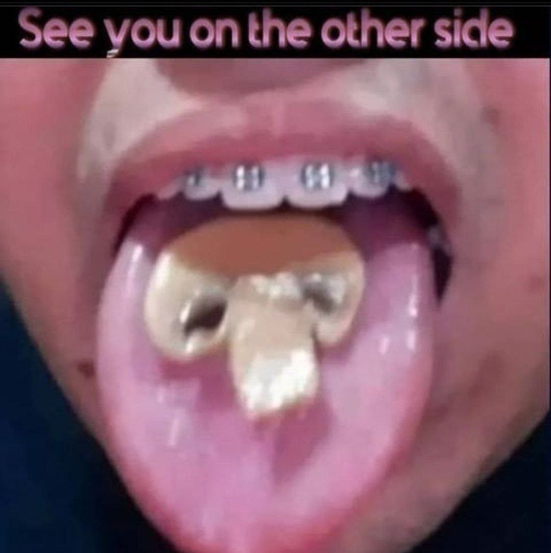 See уси on the other