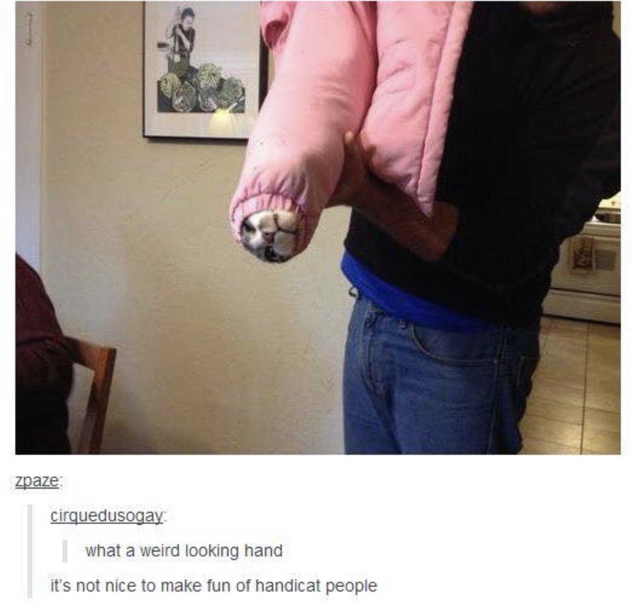 2 zpaze cirquedusogay what a weird looking hand it's not nice to make fun of handicat people