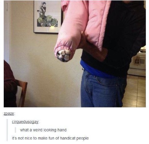 2 zpaze cirquedusogay what a weird looking hand it's not nice to make fun of handicat people