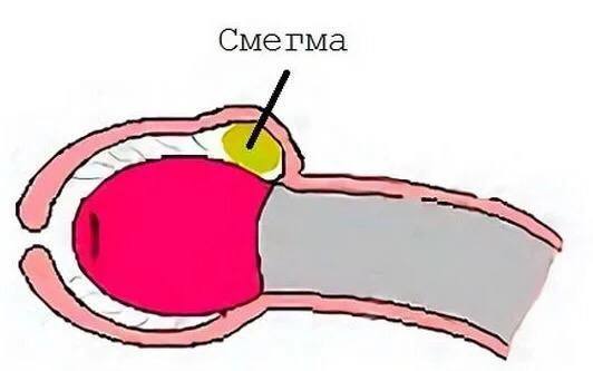 Смегма
