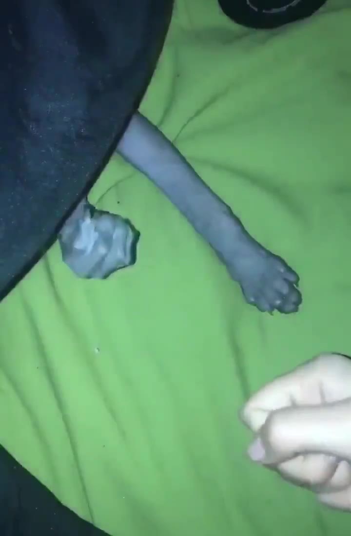 🫳