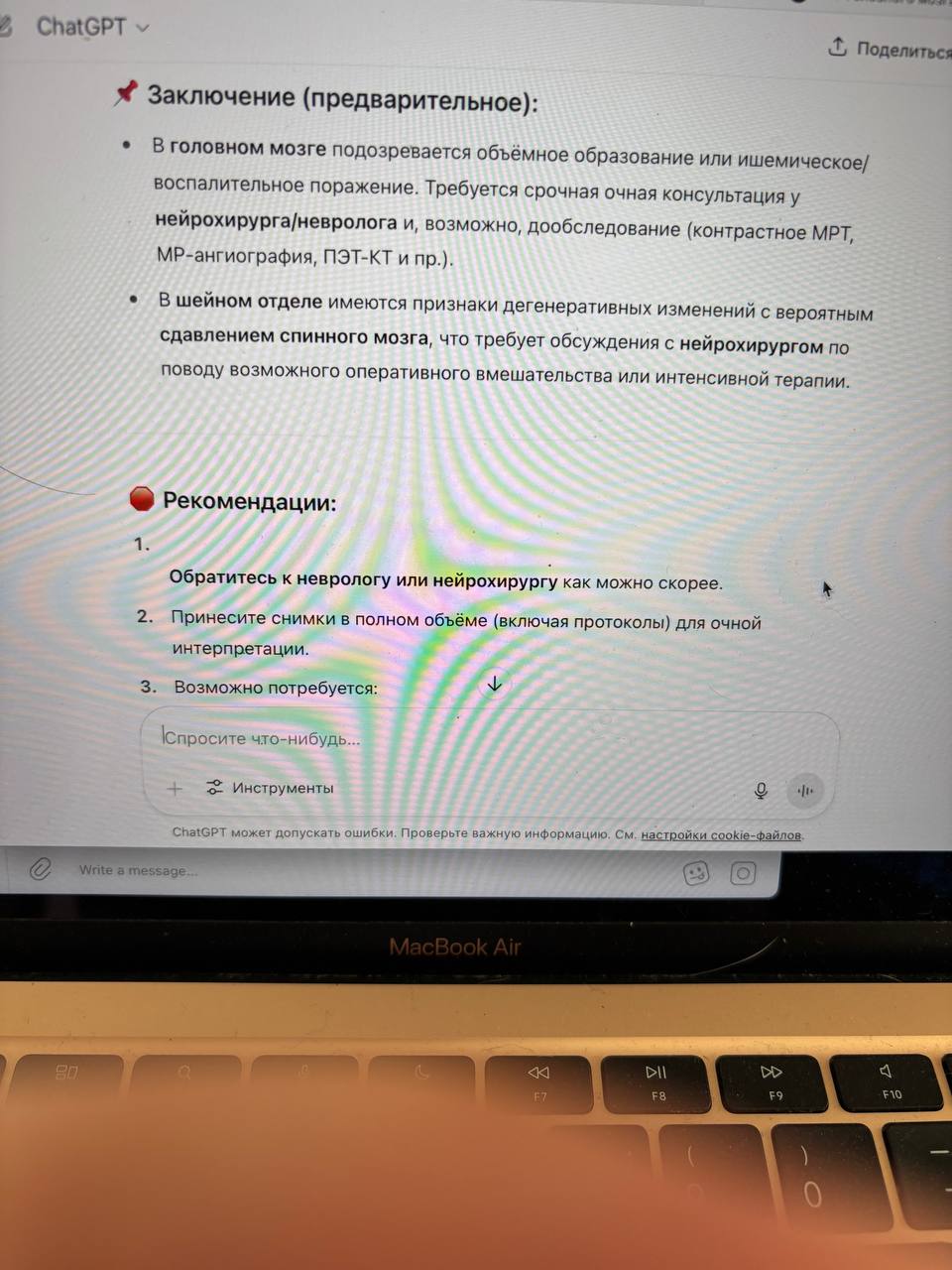 ChatGPT Поделиться Заключение (предварительное): Вголовном мозге подозревается объёмное образование или ишемическое/ воспалительное поражение. Требуется срочная очная консультация и, возможно, дообсле