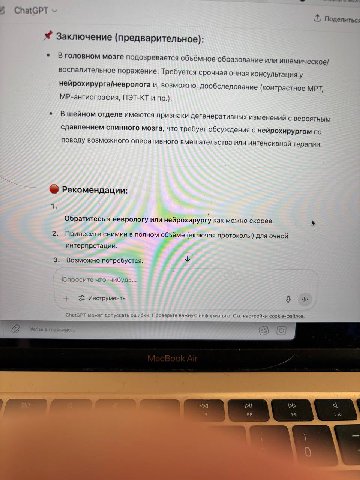 ChatGPT Поделиться Заключение (предварительное): Вголовном мозге подозревается объёмное образование или ишемическое/ воспалительное поражение. Требуется срочная очная консультация и, возможно, дообсле