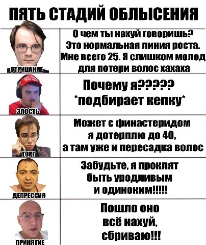 0 чем ты нахуй говоришь? Это нормальная линия роста. Мне всего 25. Я слишком молод для потери волос хахаха Почему я22222 a a Может с финастеридом я дотерплю до 40, атам уже и пересадка волос Забудьте,