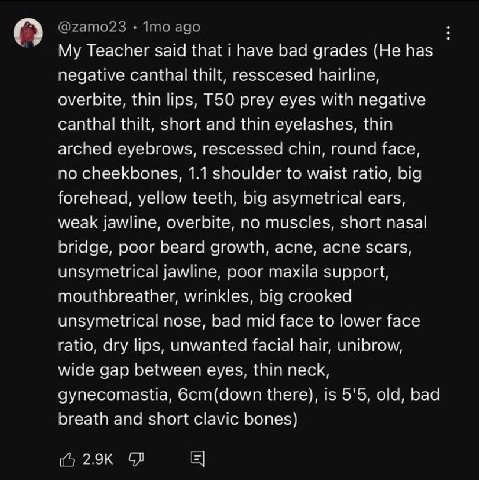 Teacher said that have bad grades (Не has negative canthal thilt, resscesed hairline, overbite, thin lips, prey eyes with negative canthal thilt, short and thin eyelashes, thin arched eyebrows, resces