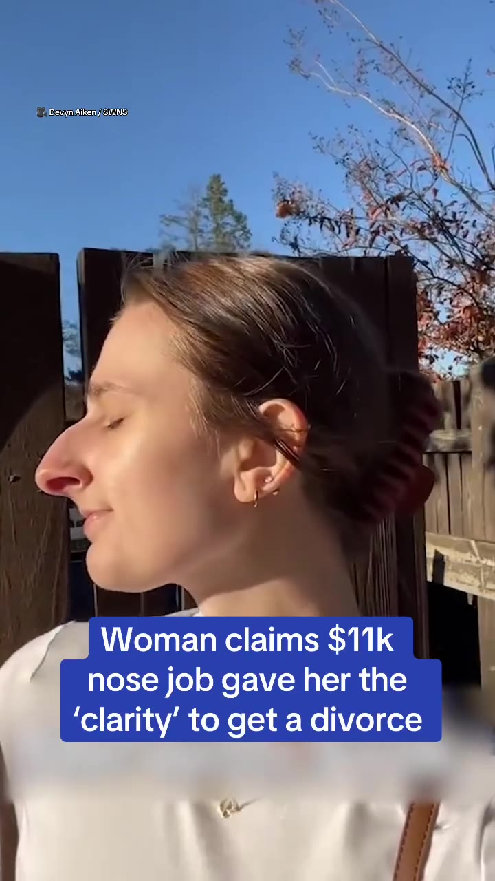 A woman who underwent an $11,000 nose job has explained how it helped her get 'clarity.' Devyn Aiken, 30, has opened up about how she 'grew apart' from her husband of seven years - with the pair separ