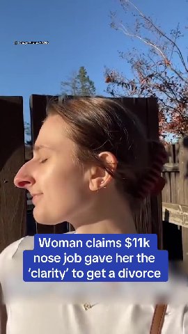 A woman who underwent an $11,000 nose job has explained how it helped her get 'clarity.' Devyn Aiken, 30, has opened up about how she 'grew apart' from her husband of seven years - with the pair separ