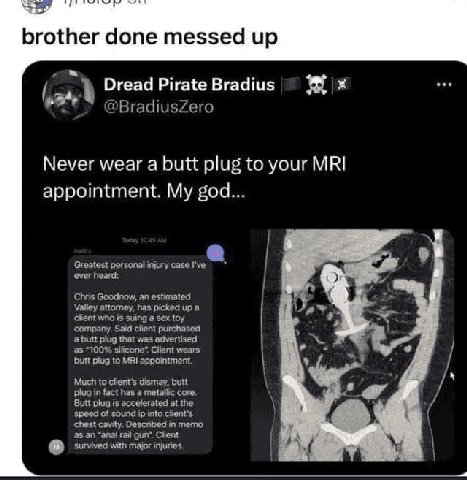 brother done messed up 4 Dread Pirate Bradius a @BradiusZero Never wear a butt plug to your MRI appointment. My god... Greatest personal injury case I've ever heard: Chris Goodnow, an estimated Valley