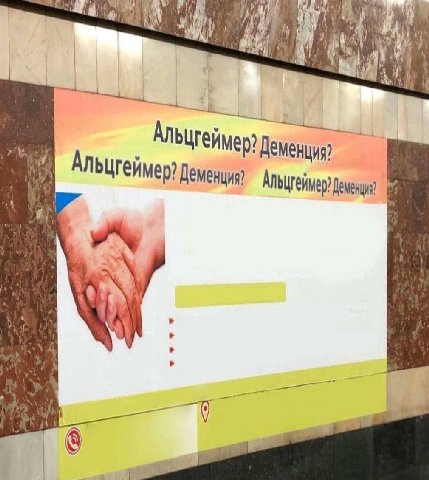 Альцгейм Деменция? я, 4