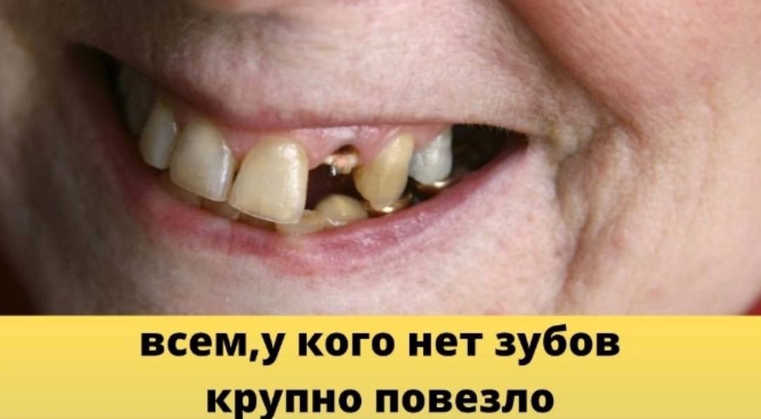 всем,у кого нет зубов крупно повезло