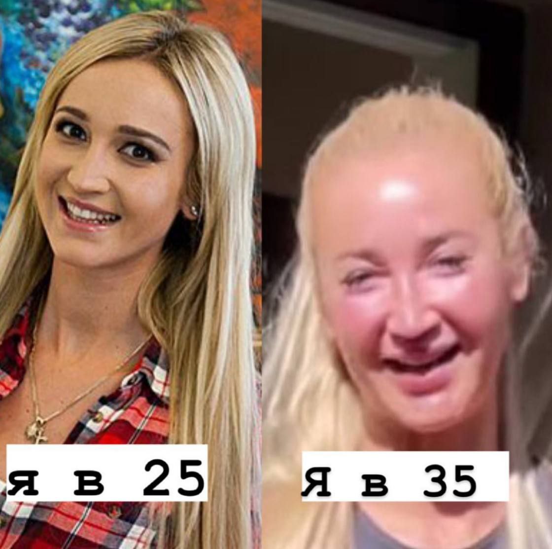 35