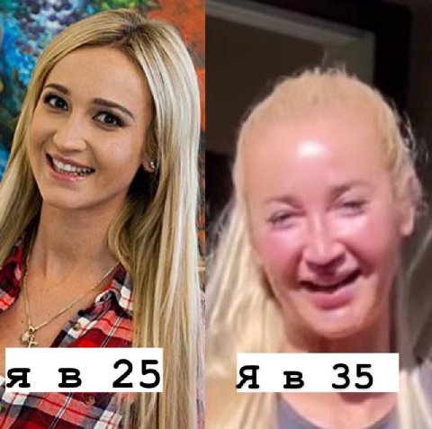 35
