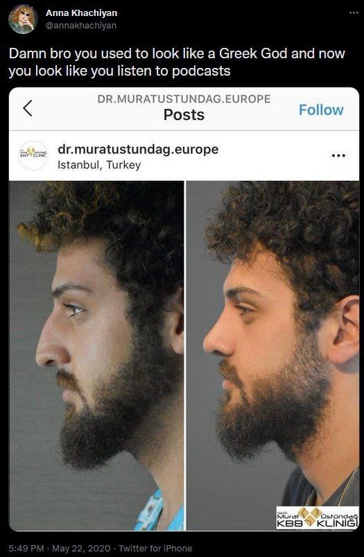 А Khachi nna аспгуап Damn bro you used to look like a Greek God and now you look like you listen to podcasts DR.MURATUSTUNDAG.EUROPE Istanbul, Turkey KLINI