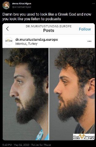 А Khachi nna аспгуап Damn bro you used to look like a Greek God and now you look like you listen to podcasts DR.MURATUSTUNDAG.EUROPE Istanbul, Turkey KLINI