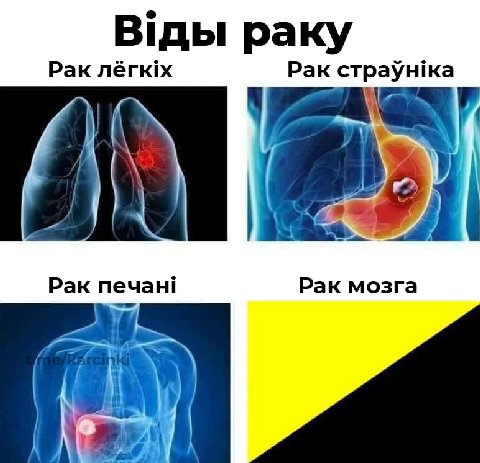 В'ды раку Рак лёгкх Pak страунка Рак печан! Рак мозга