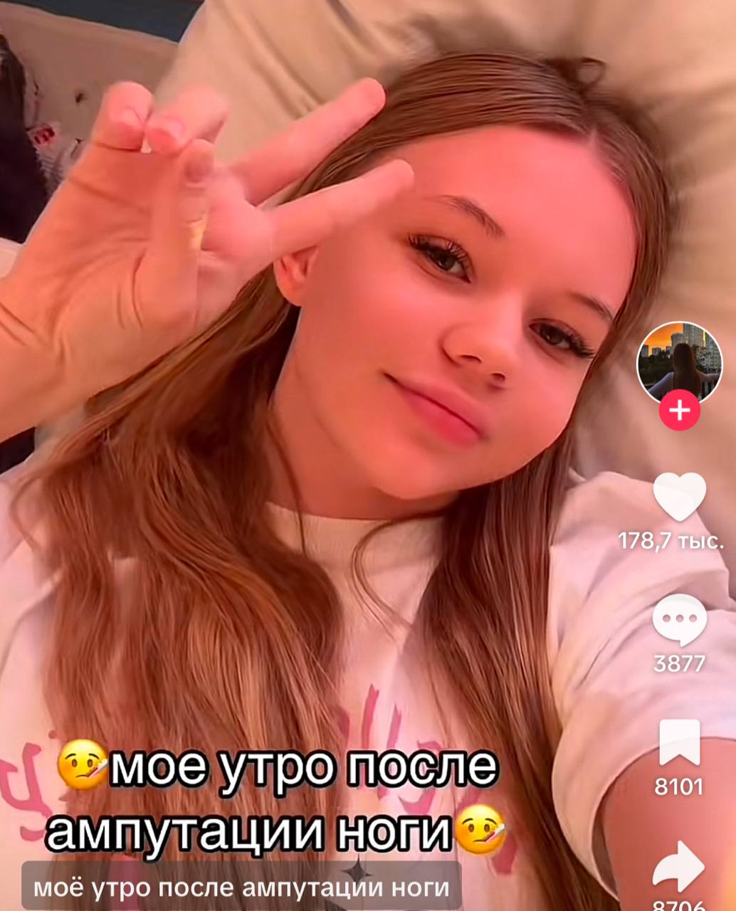 *мое утро после 8101 ампутации нови моё утро после ампутации ноги