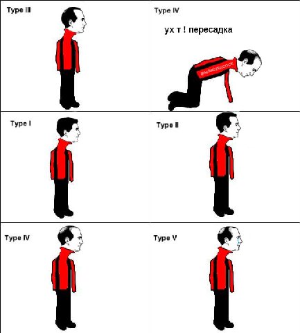 Туре Туре ухт! пересадка Type Type Type Type
