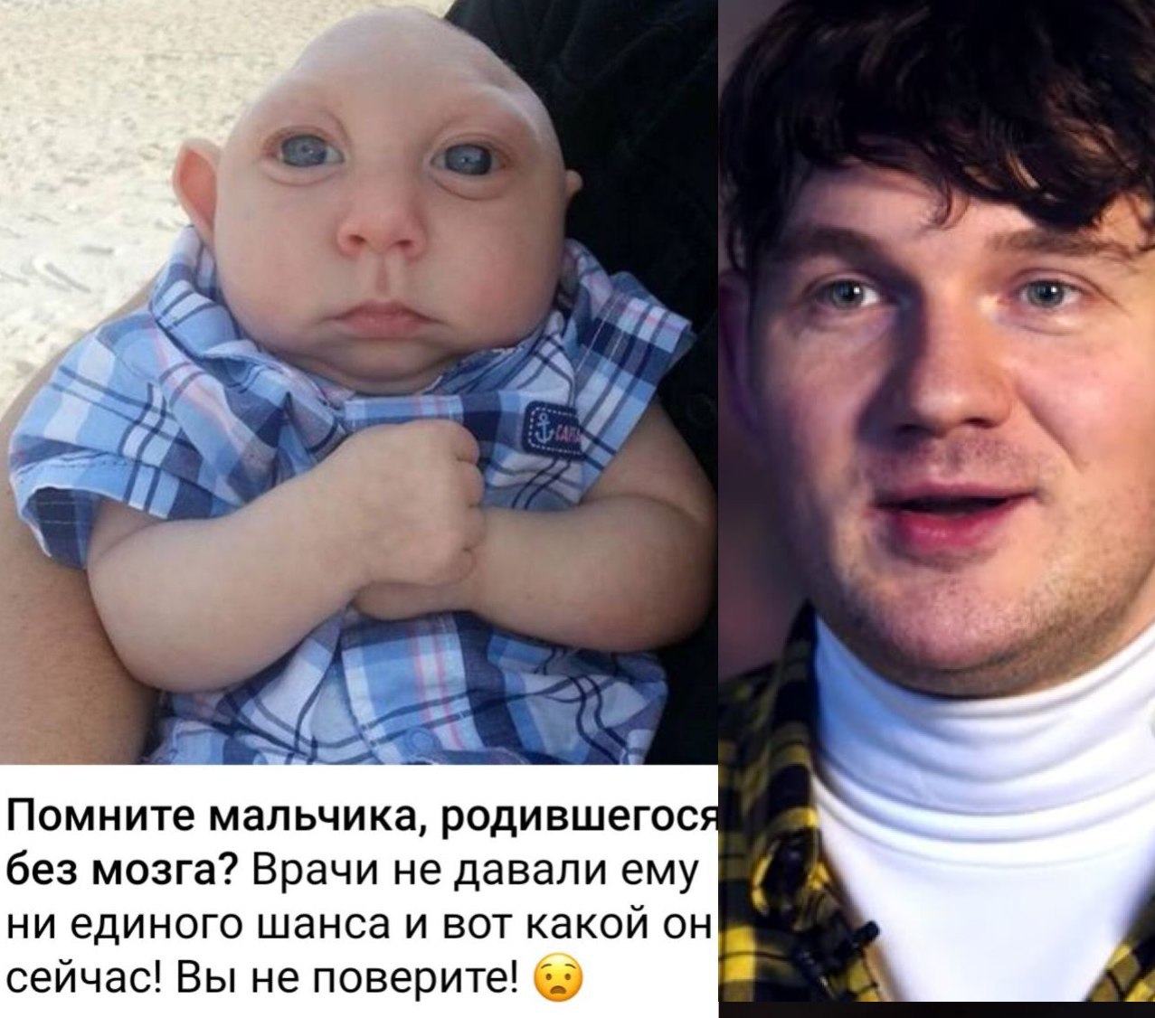 a Помните мальчика, родившегося без мозга? Врачи не давали ему ни единого шанса и вот какой он сейчас! Вы не поверите! (6.