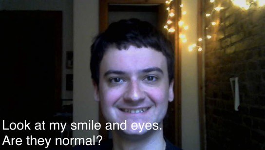 Look at my smile Are they normal?