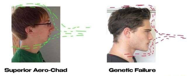 7 4 Superior Aero-Chad Genetic Failure