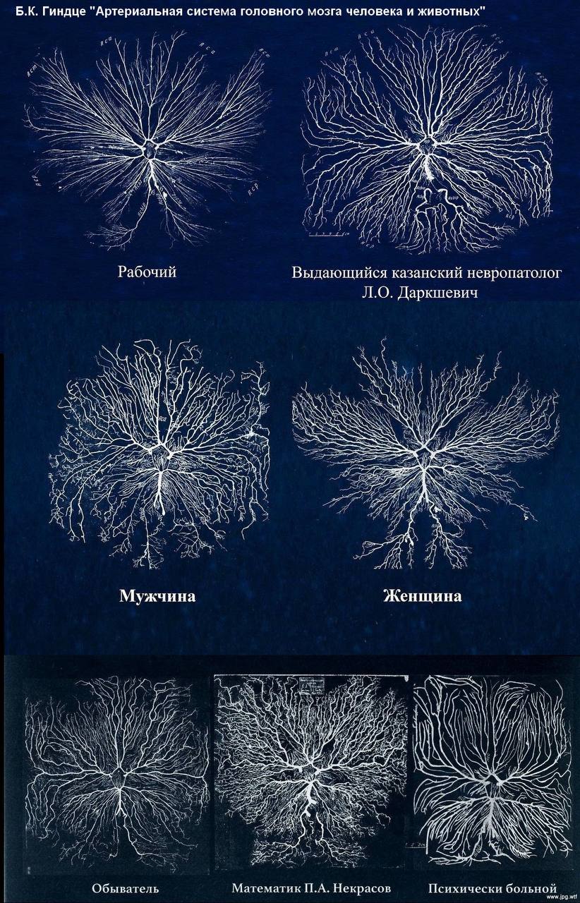 Гиндце "Артериальная система головного мозга человека и животных" у И у 20 VLE if No NSS А и и Рабочий Выдающийся казанский невропатолог Даркшевич 2 the FESS Me 4 А Мужчина Женщина А и LEG, oN, CAS Ид