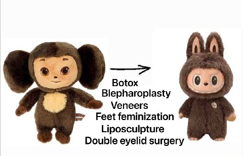 АТА Botox Blepharoplasty Veneers Feet feminization Liposculpture Double eyelid surgery