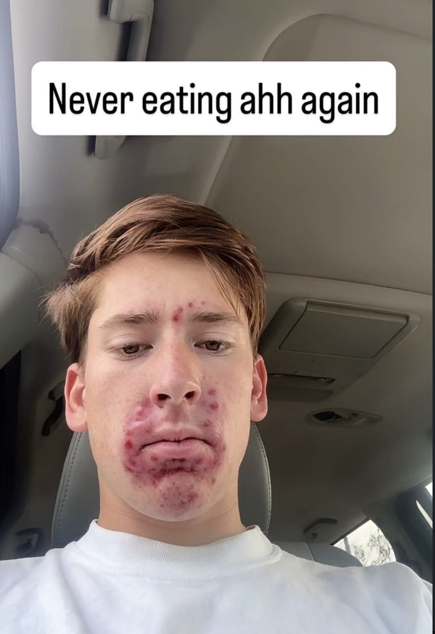 Never eating ahh again