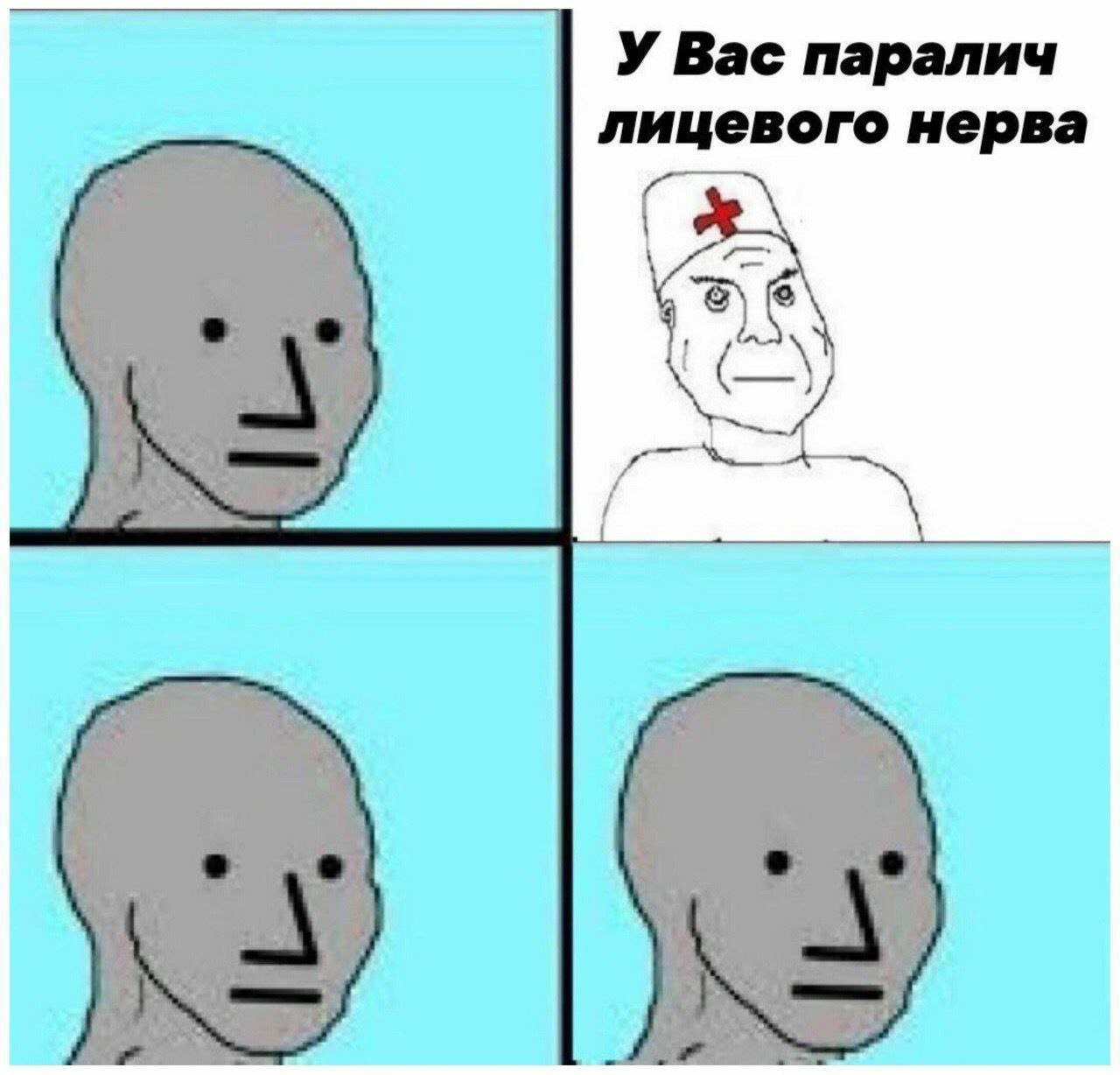 У Вас паралич лицевого нерва и