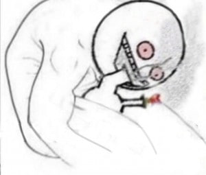 |e