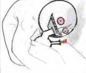 |e