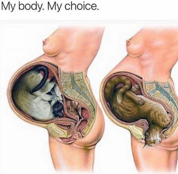 body. My choice. у