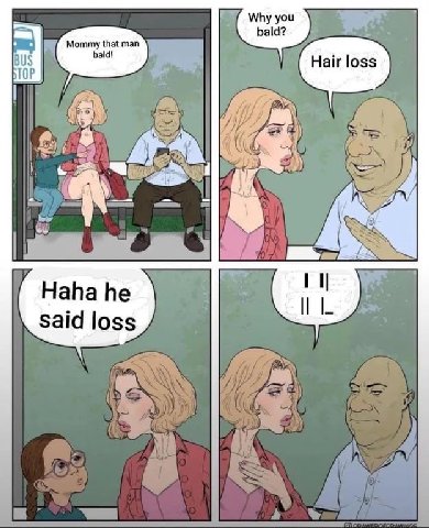 Why you bald? Mommy that man BUS TOP of I Haha he said loss
