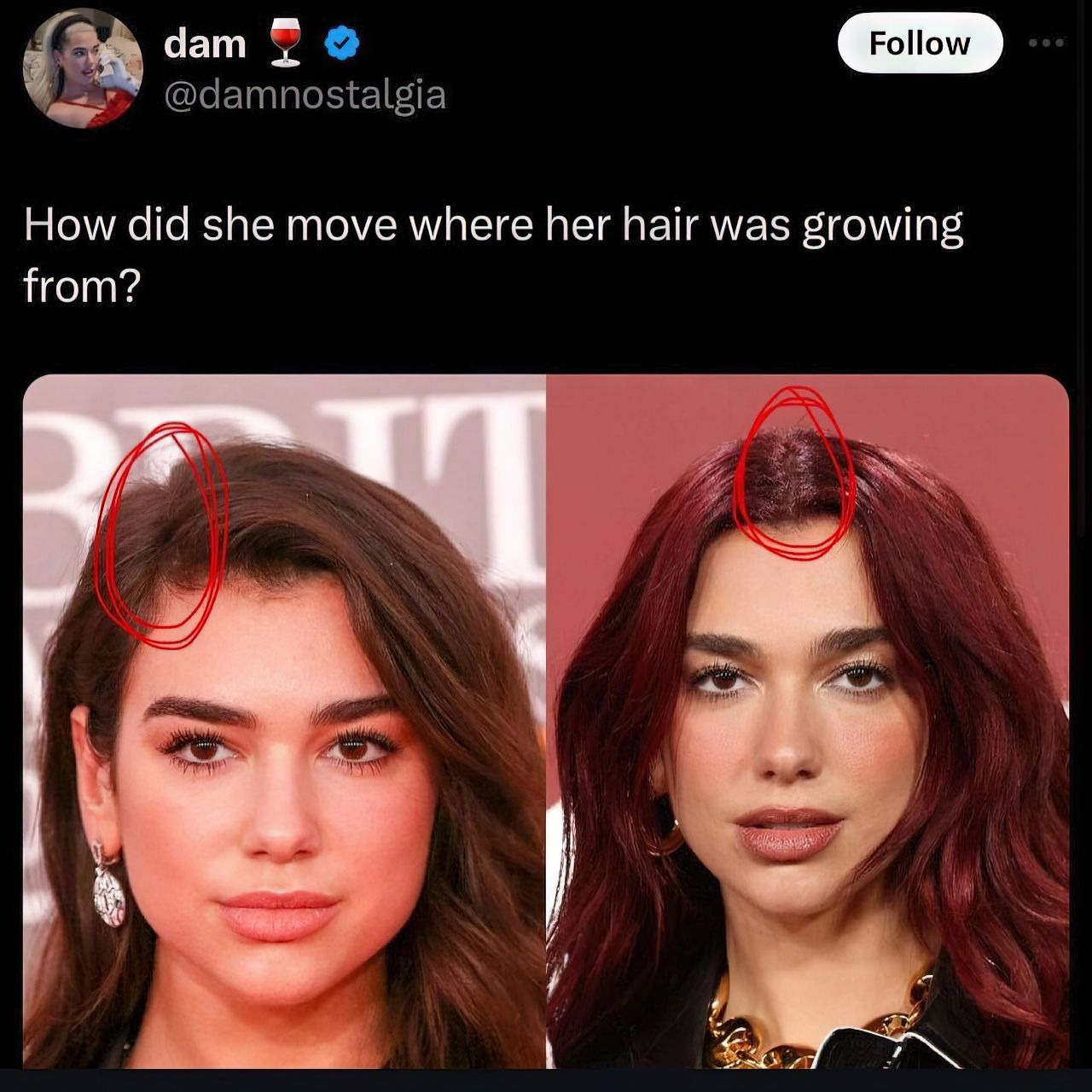 dam Follow did she move where her hair was growing from?