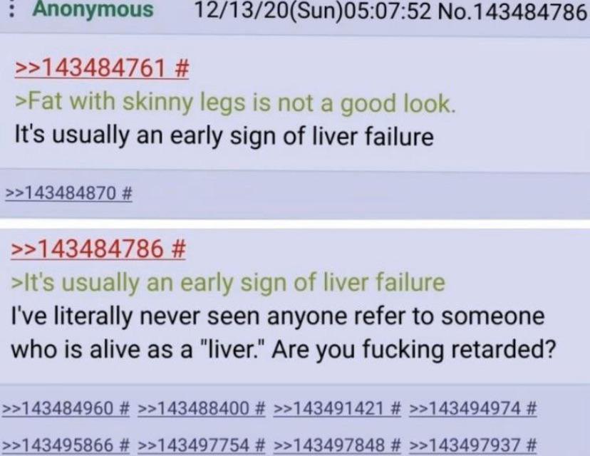 onymous 12/13/20(Sun)05:07:52 No.143484786 >>143484761 >Fat with skinny legs is not a good look. It's usually an early sign of liver failure >>143484870 >>143484786 >It's usually an early sign of live