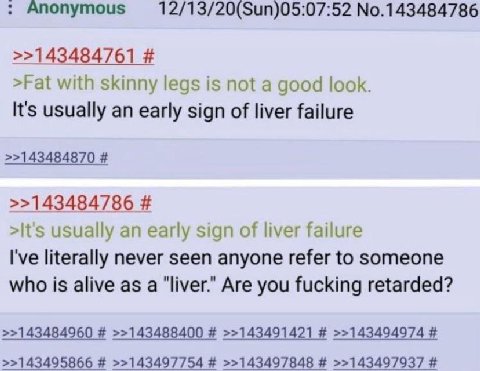 onymous 12/13/20(Sun)05:07:52 No.143484786 >>143484761 >Fat with skinny legs is not a good look. It's usually an early sign of liver failure >>143484870 >>143484786 >It's usually an early sign of live