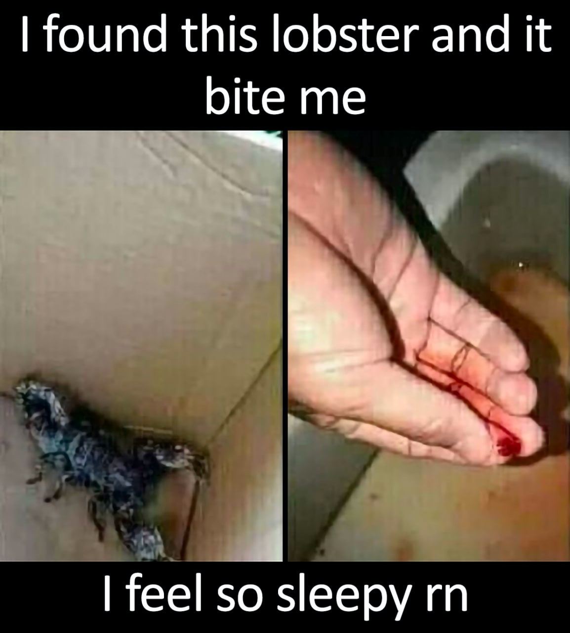 found this lobster and it bite me feel so sleepy