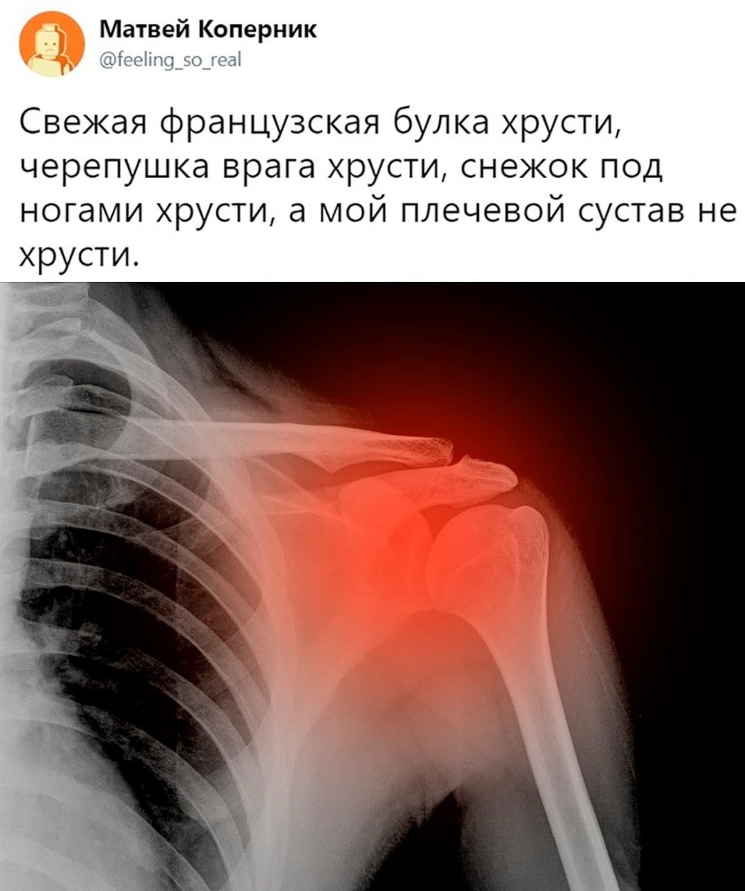 Матвей Коперник Свежая французская булка хрусти, черепушка врага хрусти, снежок под ногами хрусти, а мой плечевой сустав не хрусти.