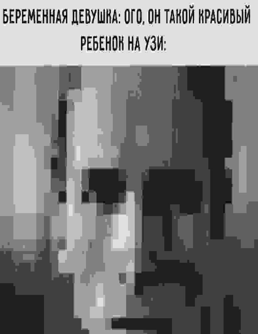 БЕРЕМЕННАЯ ДЕВУШНА: ОГО, ОН ТАНОЙ КРАСИВЫЙ РЕБЕНОН НА УЗИ: