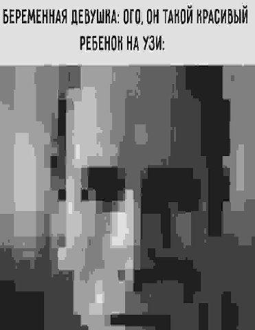 БЕРЕМЕННАЯ ДЕВУШНА: ОГО, ОН ТАНОЙ КРАСИВЫЙ РЕБЕНОН НА УЗИ: