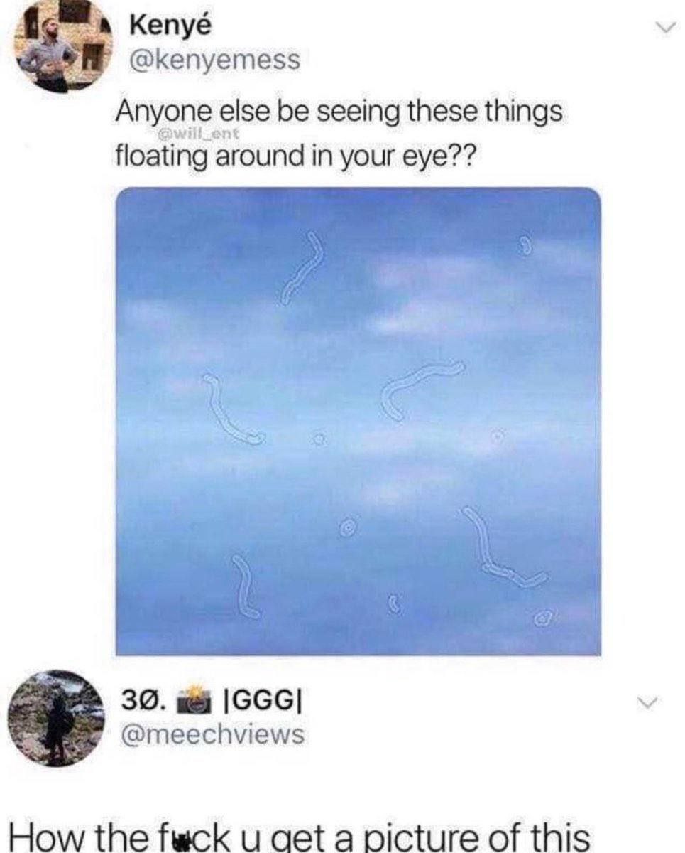 кепуё @kenyemess Anyone else be seeing these things floating around in your eye?? 39. @meechviews How the вск и aet a picture of this