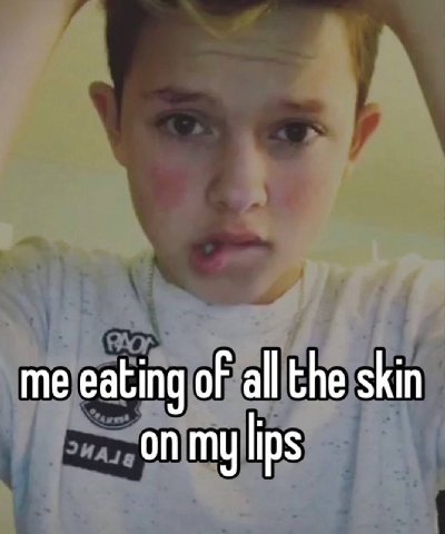 me eating of all the skin on my lips