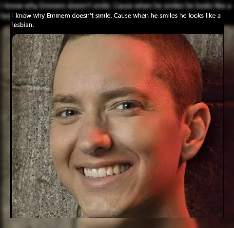 know why Eminem doesn't smile. Cause when he smiles he looks like a lesbian. i