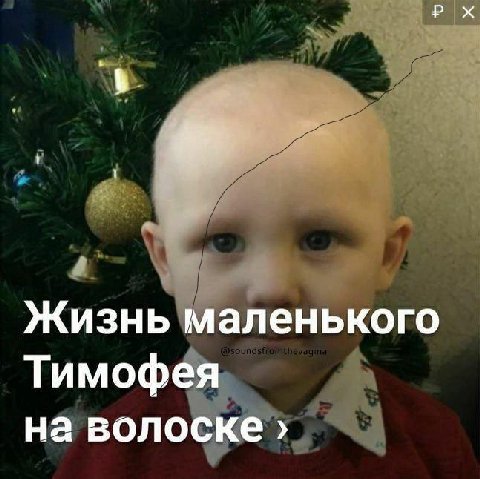 Жизнь маленького Тимофея на волоске